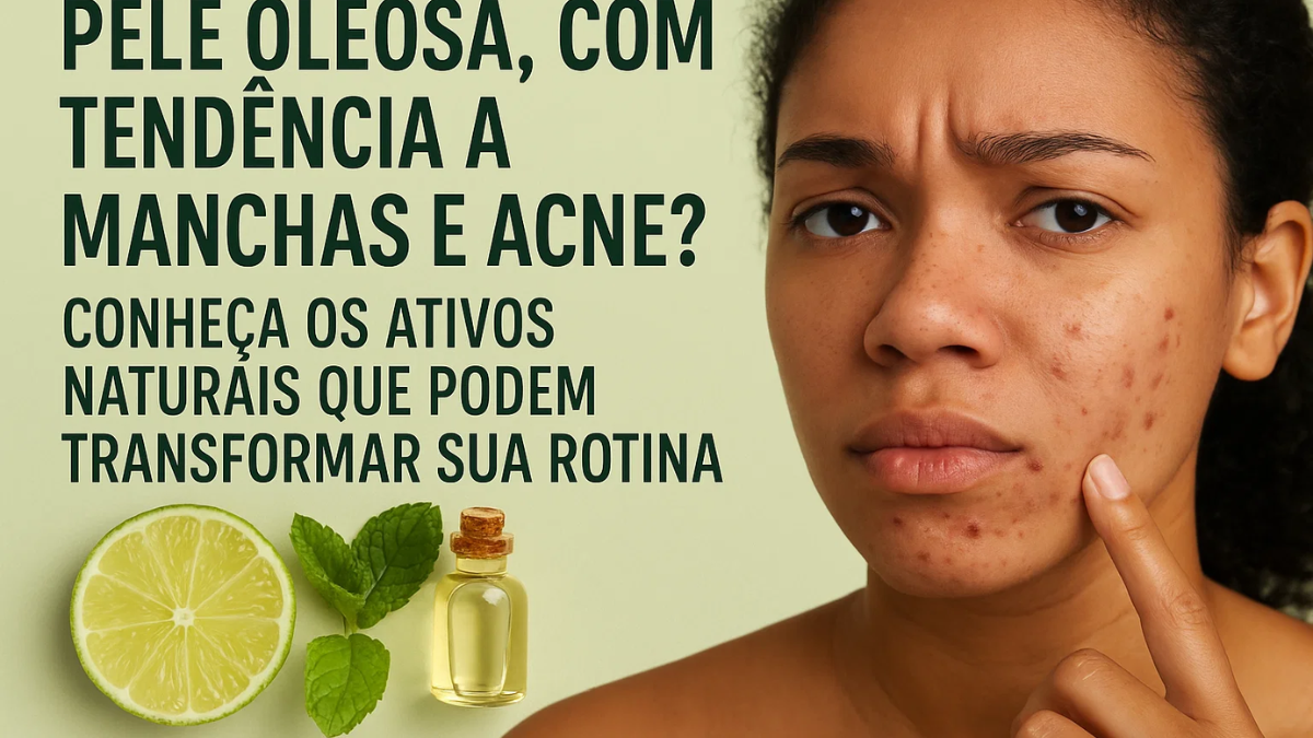 Pele Oleosa, com Tendência a Manchas e Acne? Conheça os Ativos Naturais Que Podem Transformar Sua Rotina